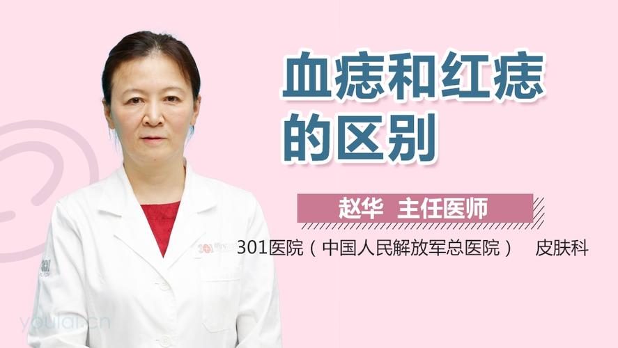 命理上红痣的意义 女人最吉利的红痣